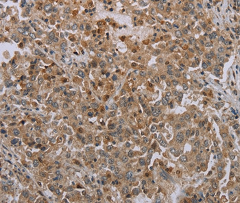 Mig-6 Antibody in Immunohistochemistry (Paraffin) (IHC (P))