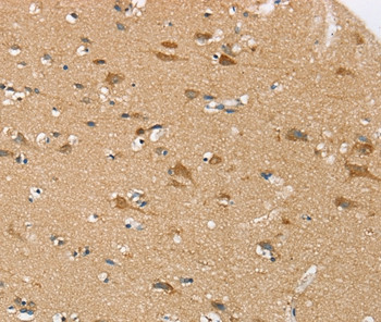 SEZ6L Antibody in Immunohistochemistry (Paraffin) (IHC (P))