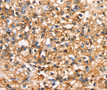 SLC34A3 Antibody in Immunohistochemistry (Paraffin) (IHC (P))