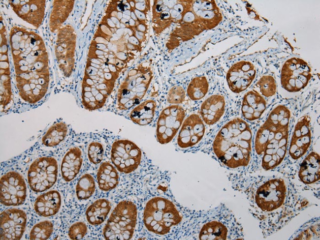 SULT1B1 Antibody in Immunohistochemistry (Paraffin) (IHC (P))