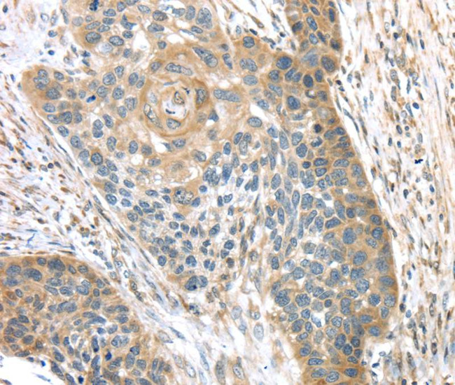 TMPRSS11A Antibody in Immunohistochemistry (Paraffin) (IHC (P))