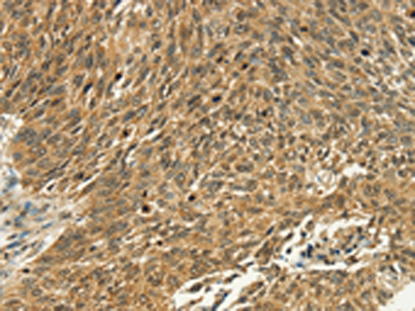 PSMD10 Antibody in Immunohistochemistry (Paraffin) (IHC (P))