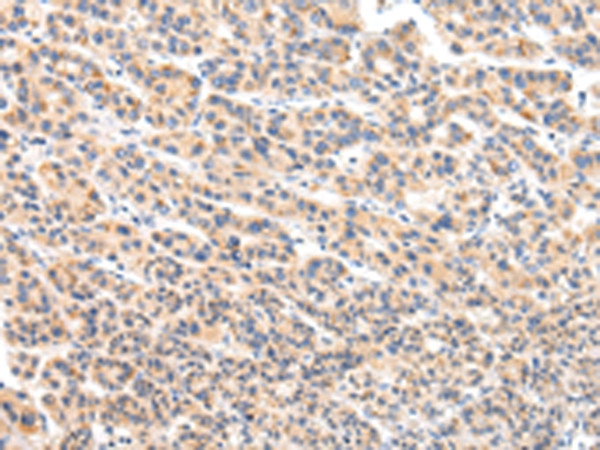 VPS54 Antibody in Immunohistochemistry (Paraffin) (IHC (P))