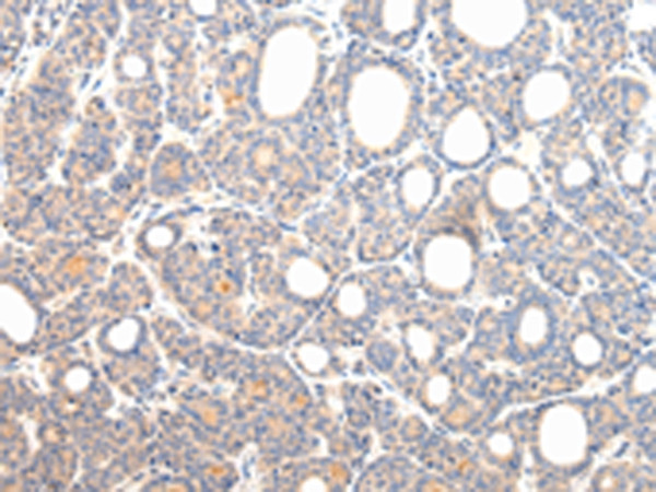 VPS54 Antibody in Immunohistochemistry (Paraffin) (IHC (P))