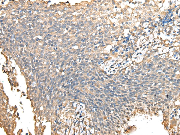 PRSS38 Antibody in Immunohistochemistry (Paraffin) (IHC (P))