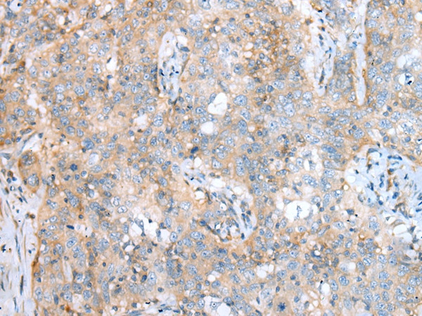 SDCCAG8 Antibody in Immunohistochemistry (Paraffin) (IHC (P))