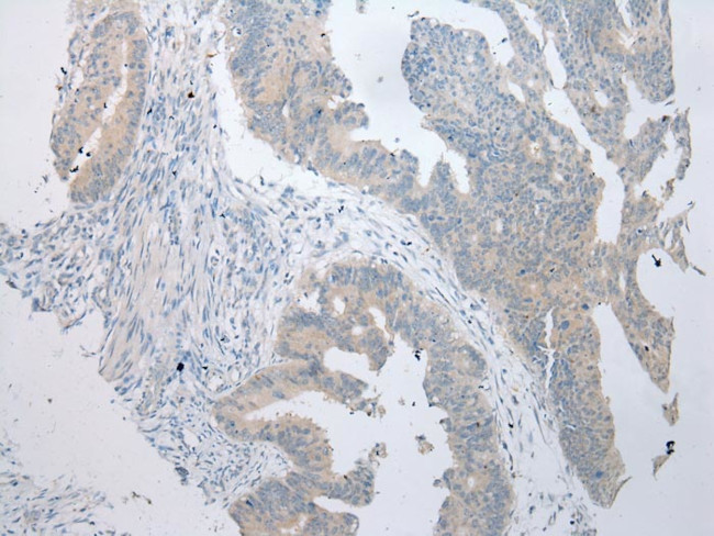 BBS9 Antibody in Immunohistochemistry (Paraffin) (IHC (P))