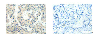 HTR2A Antibody in Immunohistochemistry (Paraffin) (IHC (P))