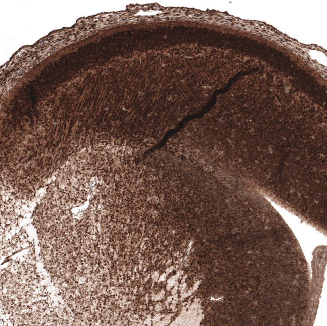 AUTS2 Antibody in Immunohistochemistry (Paraffin) (IHC (P))