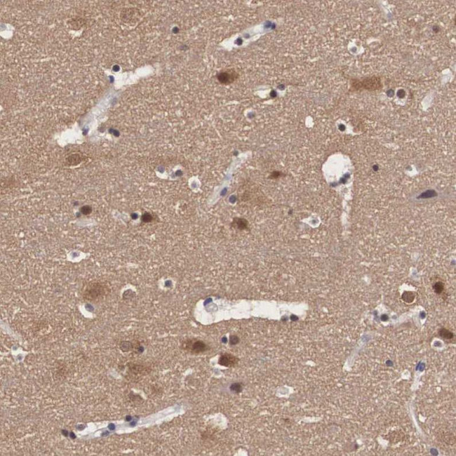 PDXP Antibody in Immunohistochemistry (IHC)