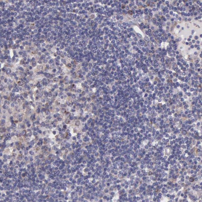 NSDHL Antibody in Immunohistochemistry (IHC)