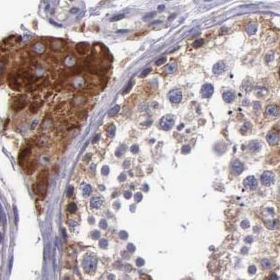 NSDHL Antibody in Immunohistochemistry (IHC)