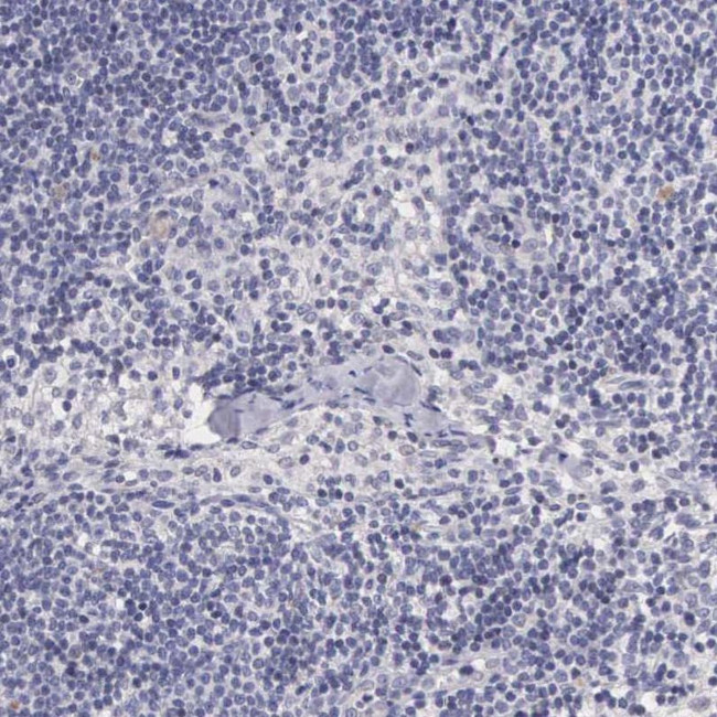 PIRIN Antibody in Immunohistochemistry (IHC)
