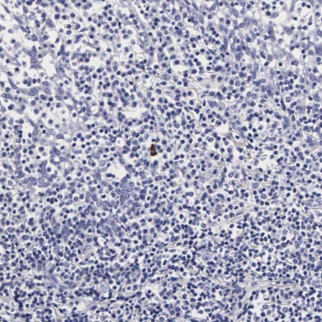 RNASE6 Antibody in Immunohistochemistry (IHC)