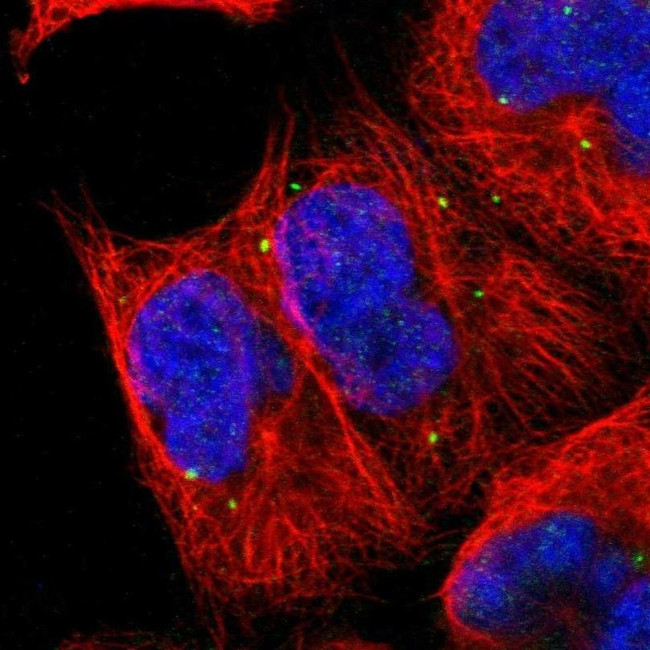 UPRT Antibody in Immunocytochemistry (ICC/IF)