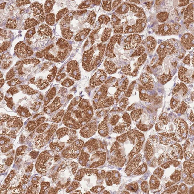 C14orf126 Antibody in Immunohistochemistry (IHC)