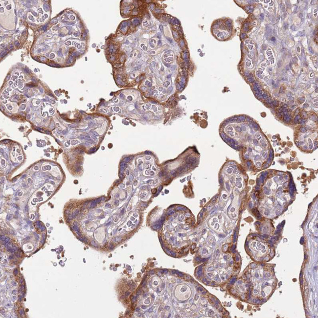 C14orf126 Antibody in Immunohistochemistry (IHC)