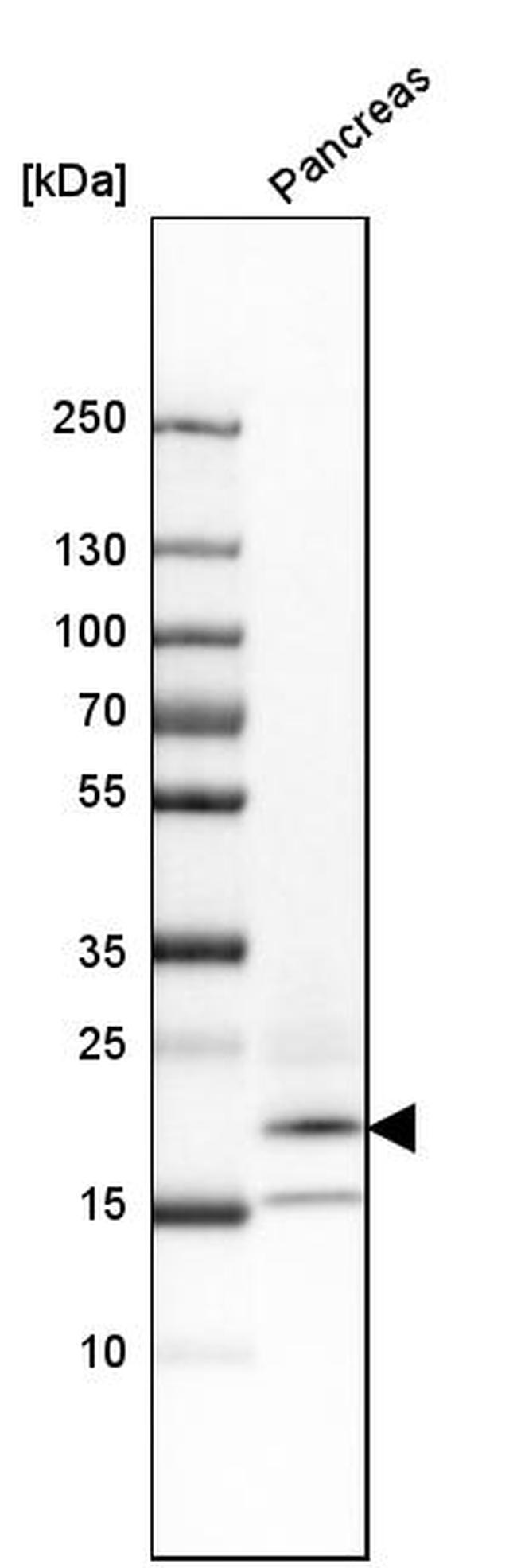 RNase1 Antibody in Western Blot (WB)