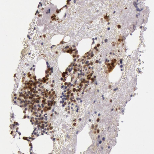 KDM6A Antibody in Immunohistochemistry (Paraffin) (IHC (P))