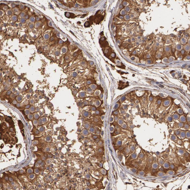 CYB5R3 Antibody in Immunohistochemistry (Paraffin) (IHC (P))