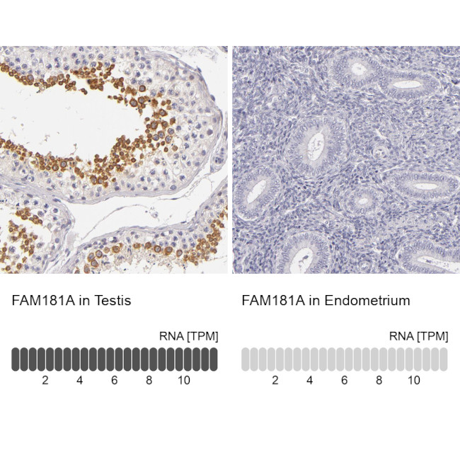 FAM181A Antibody in Immunohistochemistry (IHC)