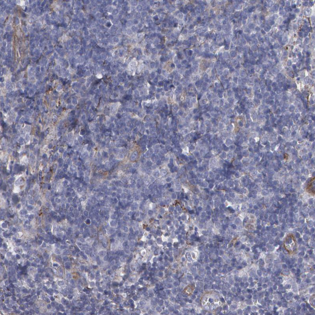 Fibulin 1 Antibody in Immunohistochemistry (Paraffin) (IHC (P))