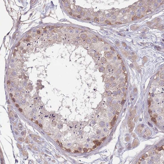 SAV1 Antibody in Immunohistochemistry (IHC)