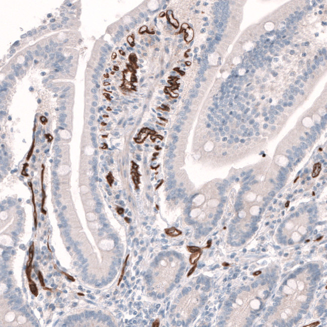 PLVAP Antibody in Immunohistochemistry (IHC)