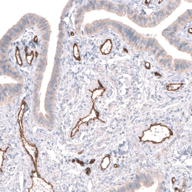 PLVAP Antibody in Immunohistochemistry (IHC)