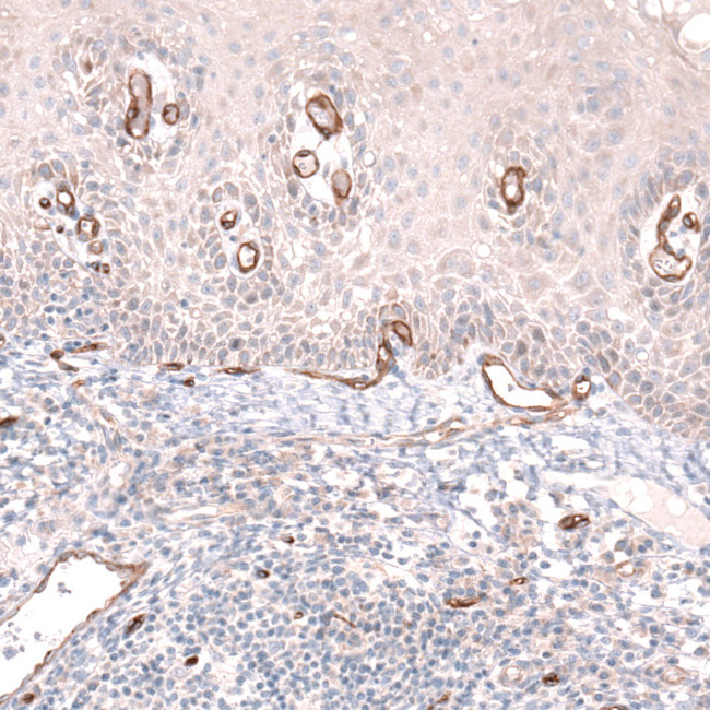 PLVAP Antibody in Immunohistochemistry (IHC)