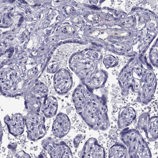 MAGEB1 Antibody in Immunohistochemistry (Paraffin) (IHC (P))