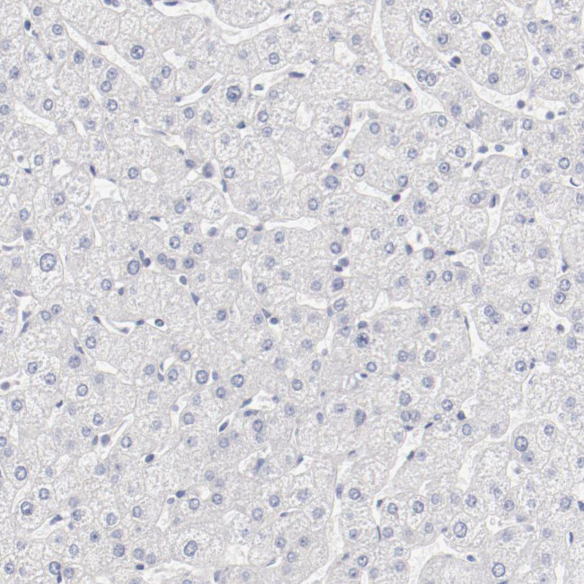 LAX1 Antibody in Immunohistochemistry (Paraffin) (IHC (P))