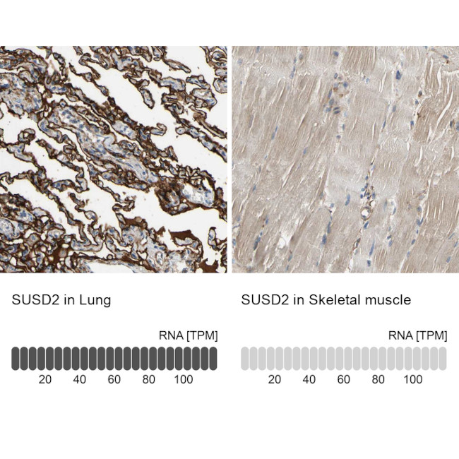 SUSD2 Antibody in Immunohistochemistry (IHC)