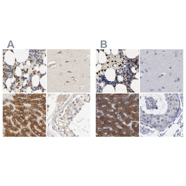 PYGL Antibody in Immunohistochemistry (IHC)