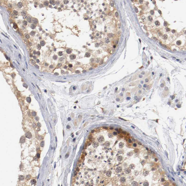 RBM23 Antibody in Immunohistochemistry (IHC)