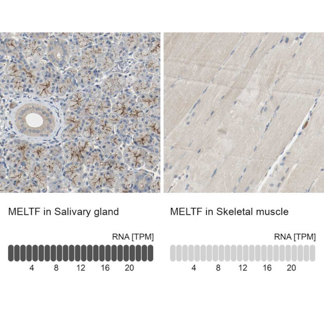 MFI2 Antibody in Immunohistochemistry (IHC)