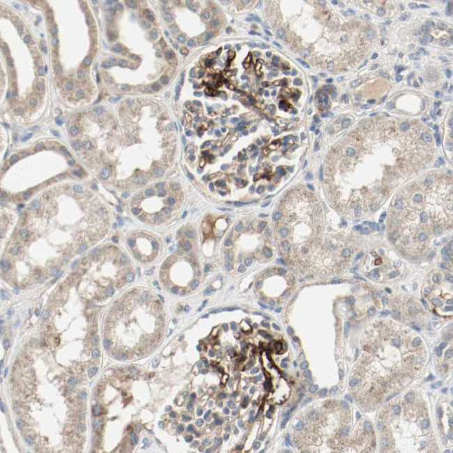 MFI2 Antibody in Immunohistochemistry (IHC)