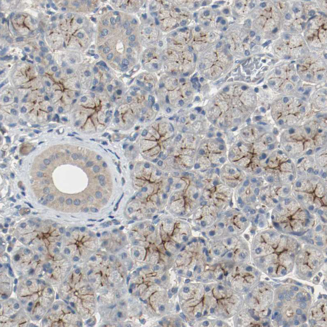 MFI2 Antibody in Immunohistochemistry (IHC)