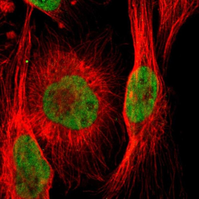 ARID1A Antibody in Immunocytochemistry (ICC/IF)