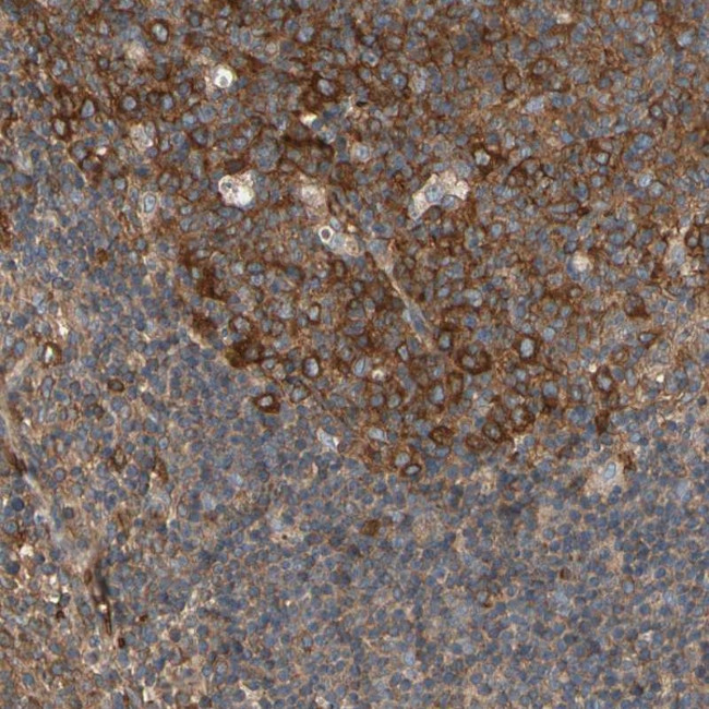 RIOK2 Antibody in Immunohistochemistry (IHC)