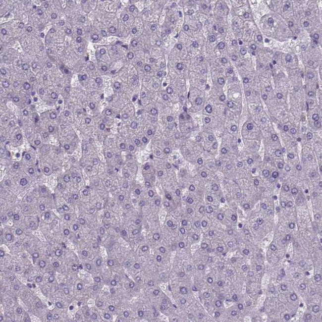 FOXJ1 Antibody in Immunohistochemistry (IHC)