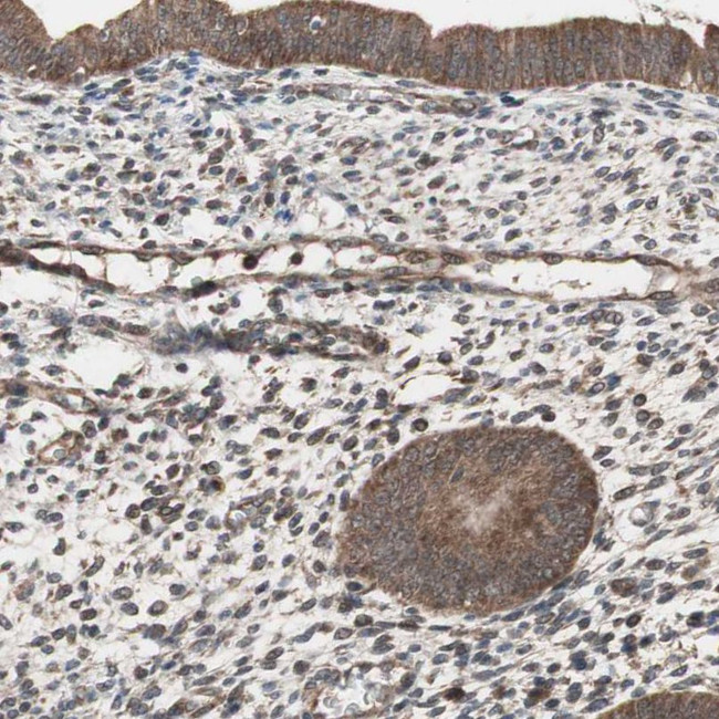 HMBS Antibody in Immunohistochemistry (IHC)