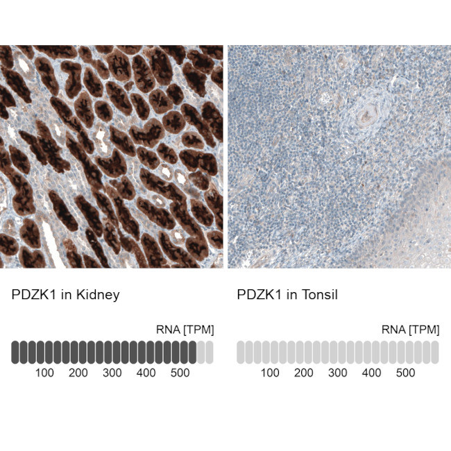 PDZK1 Antibody in Immunohistochemistry (IHC)