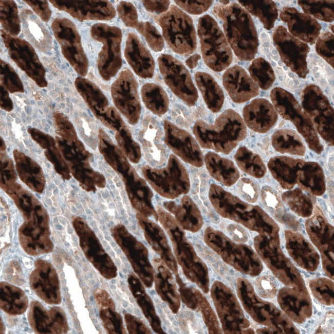 PDZK1 Antibody in Immunohistochemistry (IHC)