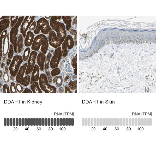 DDAH1 Antibody