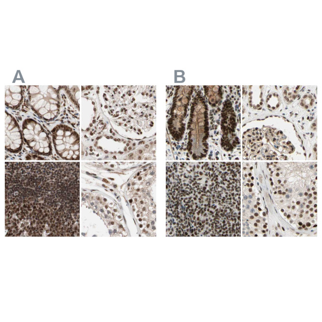 CHAMP1 Antibody in Immunohistochemistry (IHC)