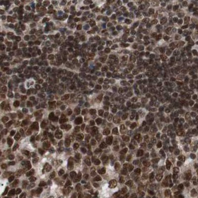 CHAMP1 Antibody in Immunohistochemistry (IHC)