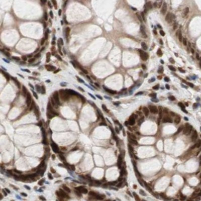 CHAMP1 Antibody in Immunohistochemistry (IHC)