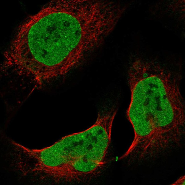 CHAMP1 Antibody in Immunocytochemistry (ICC/IF)