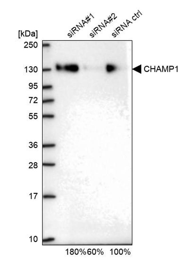 CHAMP1 Antibody in Western Blot (WB)